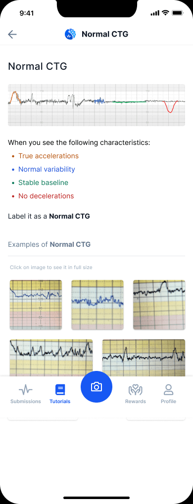 AI-Powered CTG Fetal Monitoring project preview